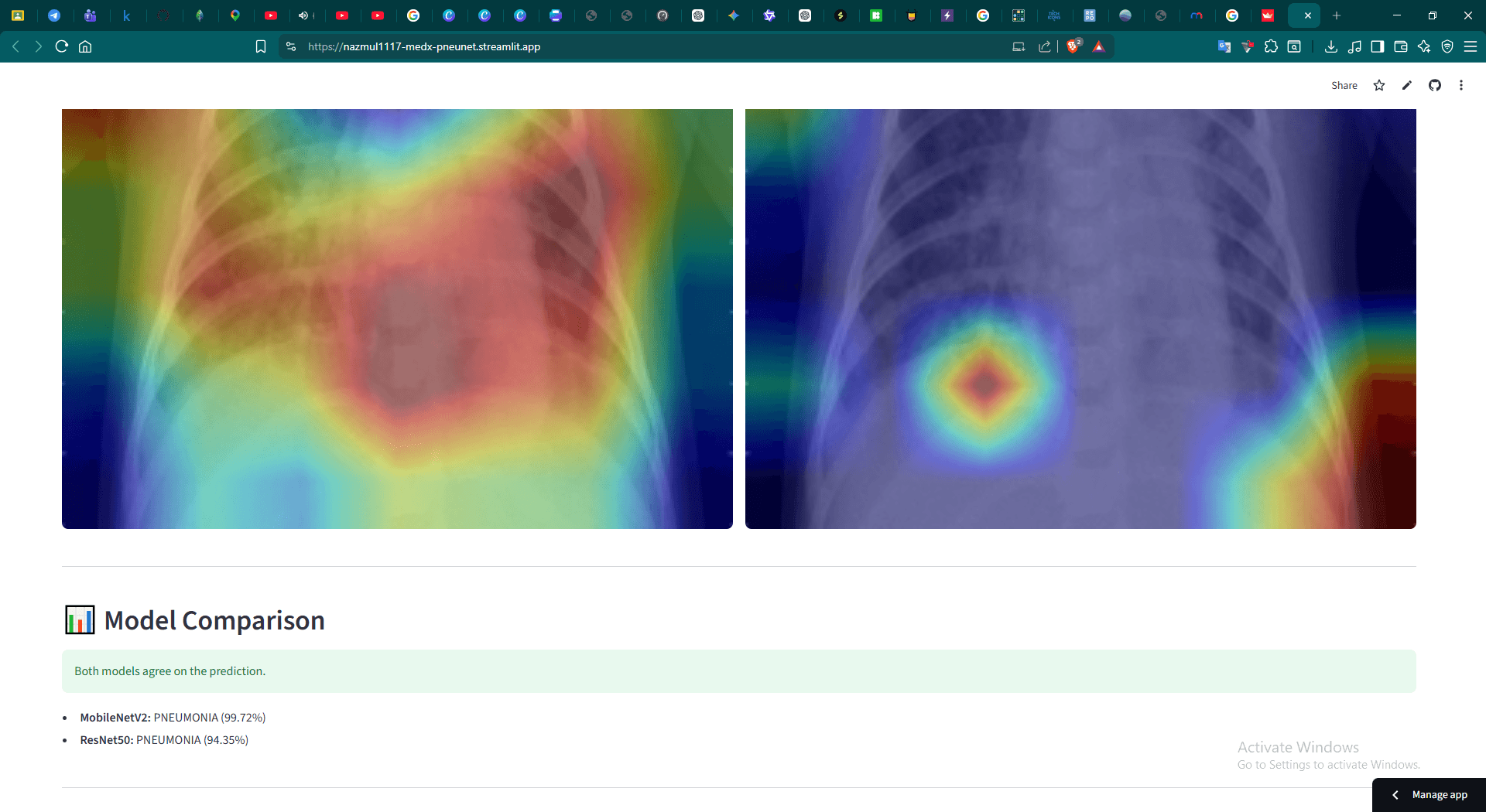Explainable AI X-Ray Framework